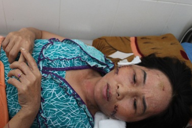 Ghen tuông, kéo cả nhà đi rạch mặt “tình địch”       