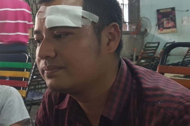 Đòi nợ, phó giám đốc bị 10 giang hồ đánh chảy máu đầu