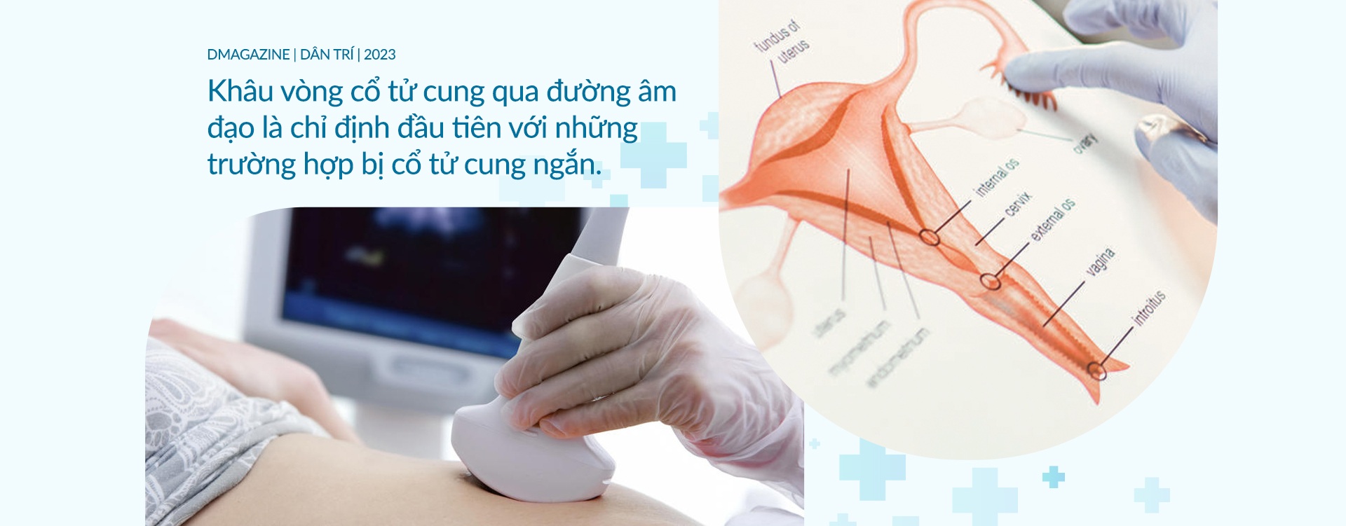 PGS Vũ Bá Quyết và phương pháp phẫu thuật cho những phụ nữ gần như vô sinh - 17 PGS Vũ Bá Quyết và phương pháp phẫu thuật cho những phụ nữ gần như vô sinh - 17