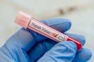 Chuyên gia: Virus Nipah có tỷ lệ tử vong cao nhưng khó lây hơn Covid-19