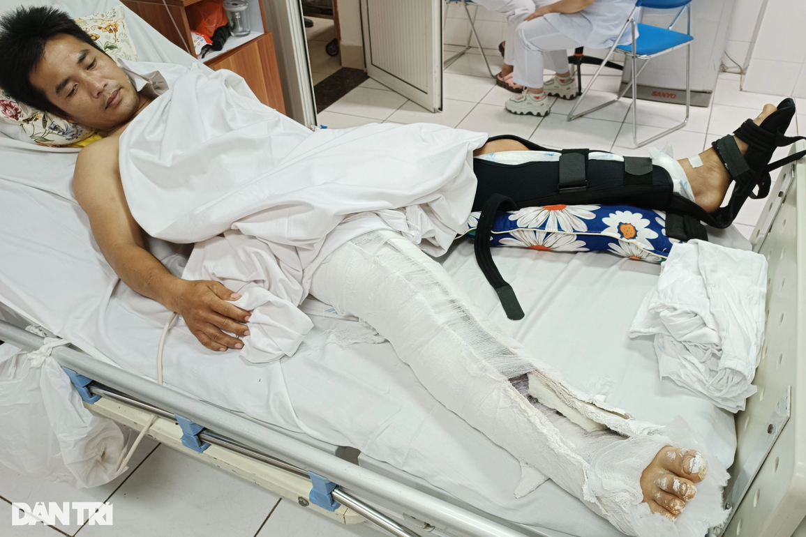 Cha gặp nạn nguy cơ tàn phế, 4 con thơ đói khát, hoảng loạn - 2 Cha gặp nạn nguy cơ tàn phế, 4 con thơ đói khát, hoảng loạn - 2