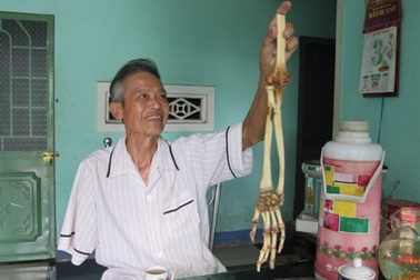 Câu chuyện về cánh tay người lính trở về sau 47 năm “chu du” ở Mỹ