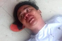 Đi nhận lương, công nhân bị giám đốc đánh gãy tay, gãy mũi