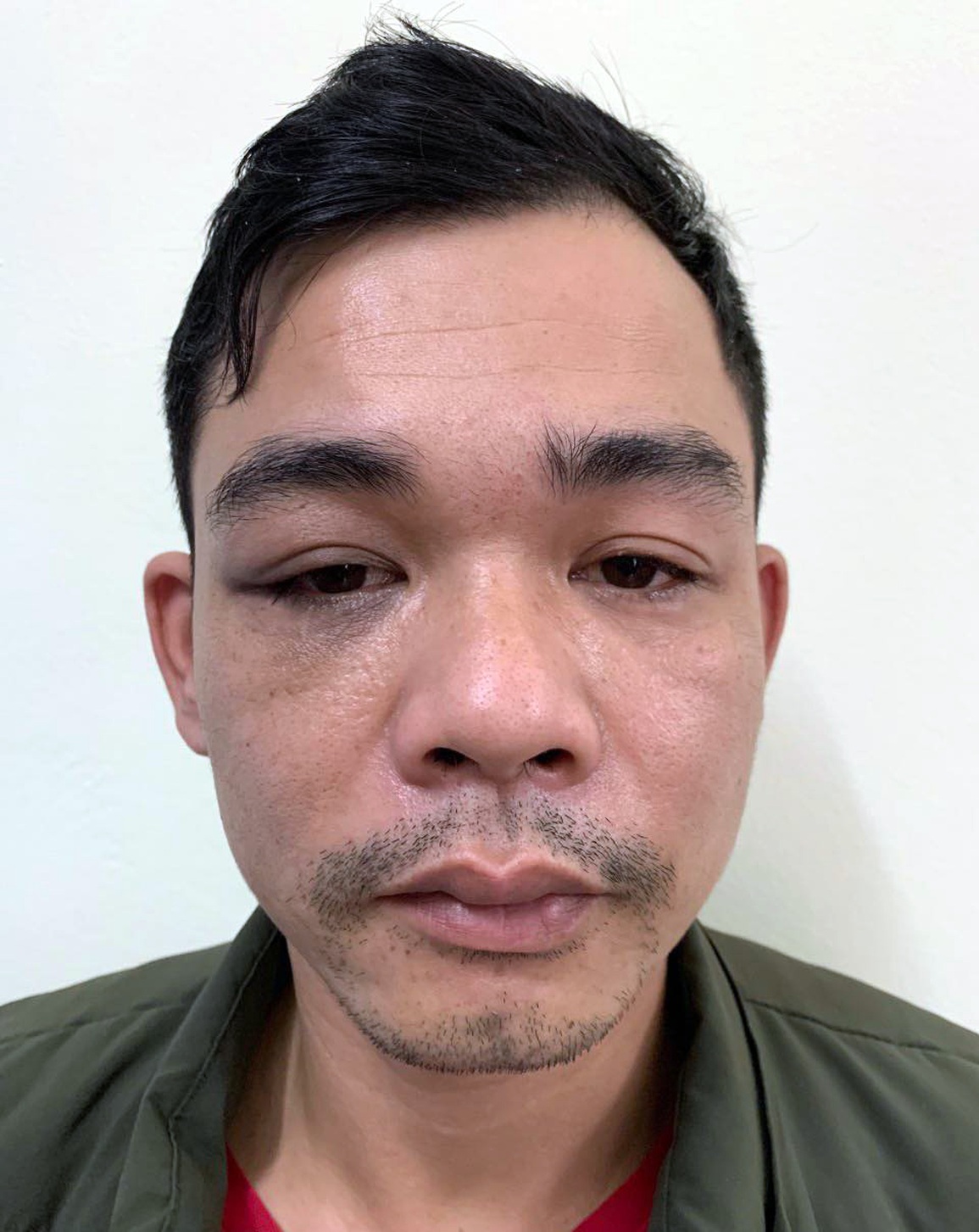 Hà Nội: Cô gái 3 lần bị bạn trai đánh thuốc mê để cướp tài sản - 1