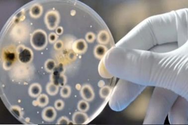 Mỹ phát hiện ca bệnh nấm nguy hiểm chết người có thể "kháng mọi loại thuốc"