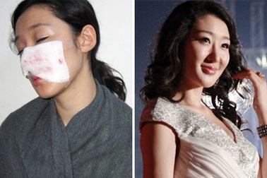 Nữ diễn viên xinh đẹp bị chó cắn rách mặt 