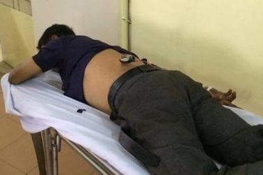 “Cẩu tặc” dùng súng điện bắn trọng thương người dân