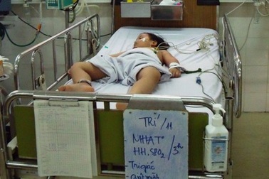 Thủ tướng yêu cầu ngăn chặn dịch tay chân miệng