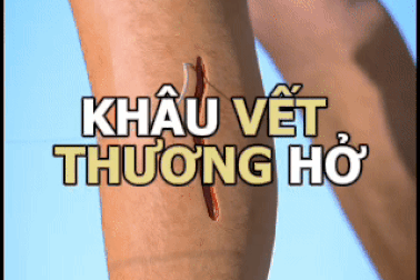 Khoa học lý giải: Chuyện gì xảy ra khi khâu vết thương hở?