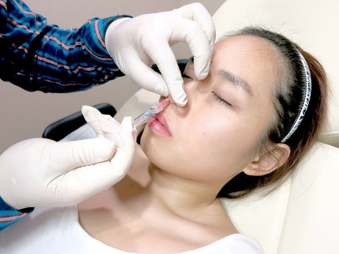 Filler – Hiểm họa từ phương pháp thẩm mĩ nội khoa khiến nhiều chị em chết mê chết mệt năm 2019 - Ảnh 1.