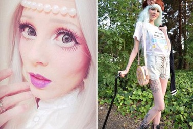 Bệnh loạn dưỡng cơ biến cô gái trẻ thành “búp bê sống”