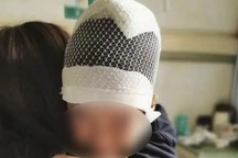 Trung Quốc bắt giữ giáo viên giật tóc làm chấn thương hộp sọ học sinh