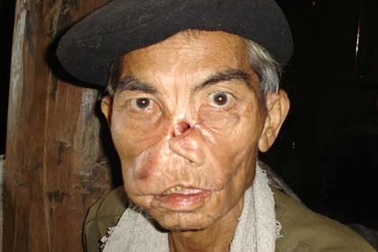 “Vua diệt sói dữ” và cuộc đời tàn phế trong ân hận