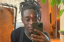 Viên kim cương bị giật khỏi trán của nam rapper