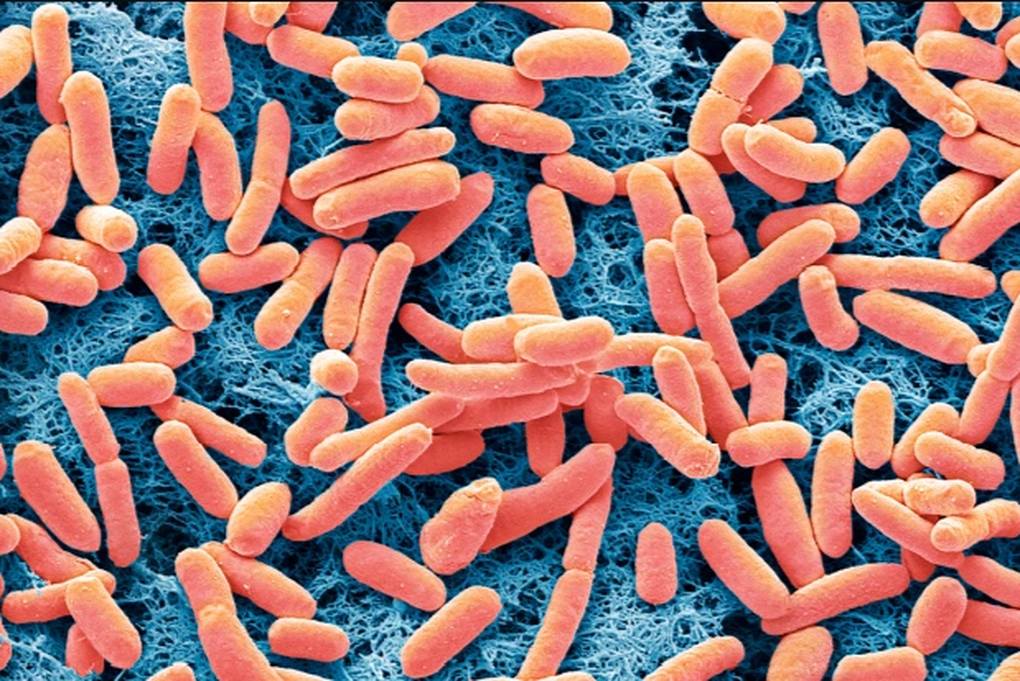 Phát minh đột phá sản xuất điện từ vi khuẩn E. coli - 1 Phát minh đột phá sản xuất điện từ vi khuẩn E. coli - 1
