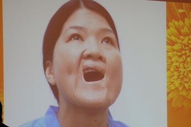 Ca sĩ Thủy Tiên được tài trợ toàn bộ chi phí phẫu thuật thẩm mỹ