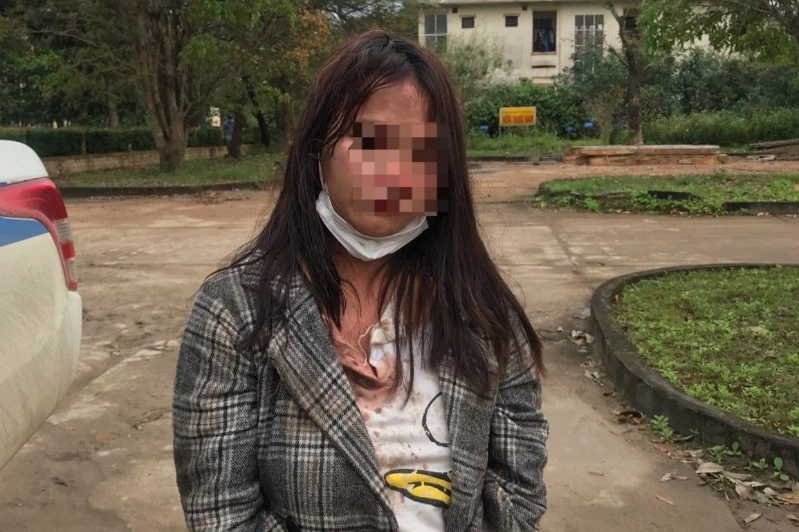 Chủ quầy gạo tri hô rượt đuổi bắt giữ nữ đạo chích giữa chợ - 1 Chủ quầy gạo tri hô rượt đuổi bắt giữ nữ đạo chích giữa chợ - 1