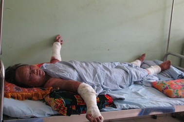 Nước mắt người mẹ bị con… tưới xăng đốt