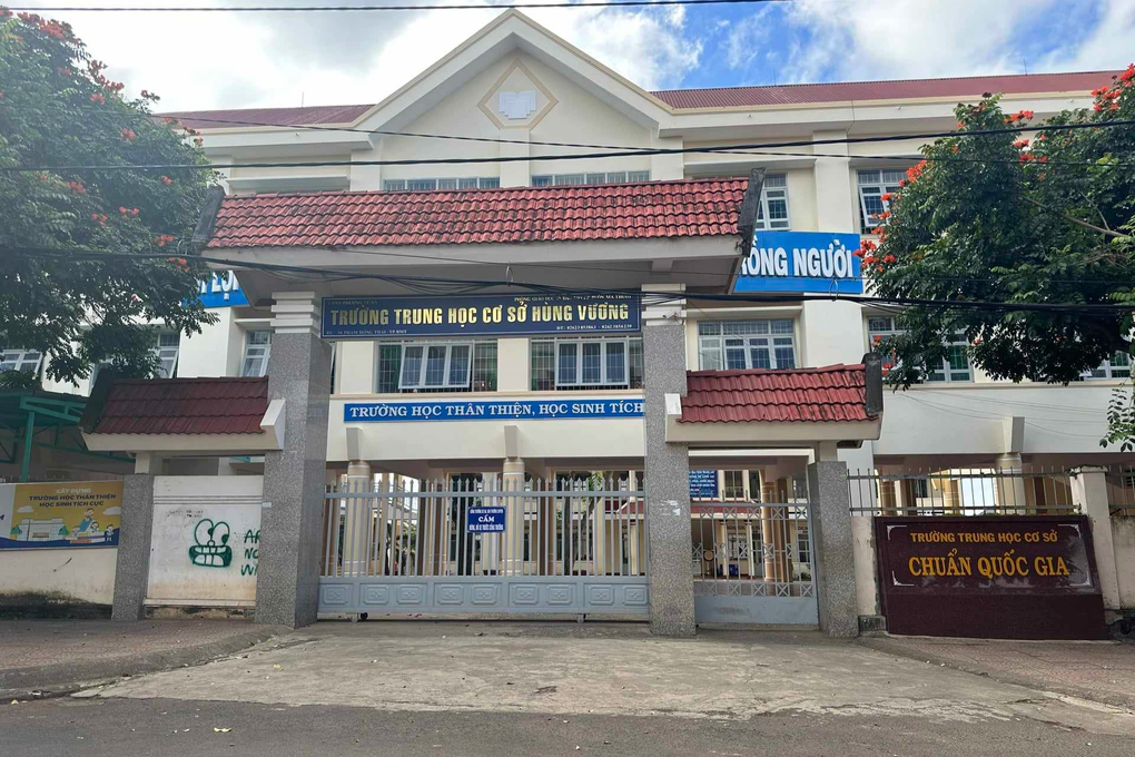 Nam sinh bị bạn đánh hội đồng, gãy ngón tay út - 2 Nam sinh bị bạn đánh hội đồng, gãy ngón tay út - 2