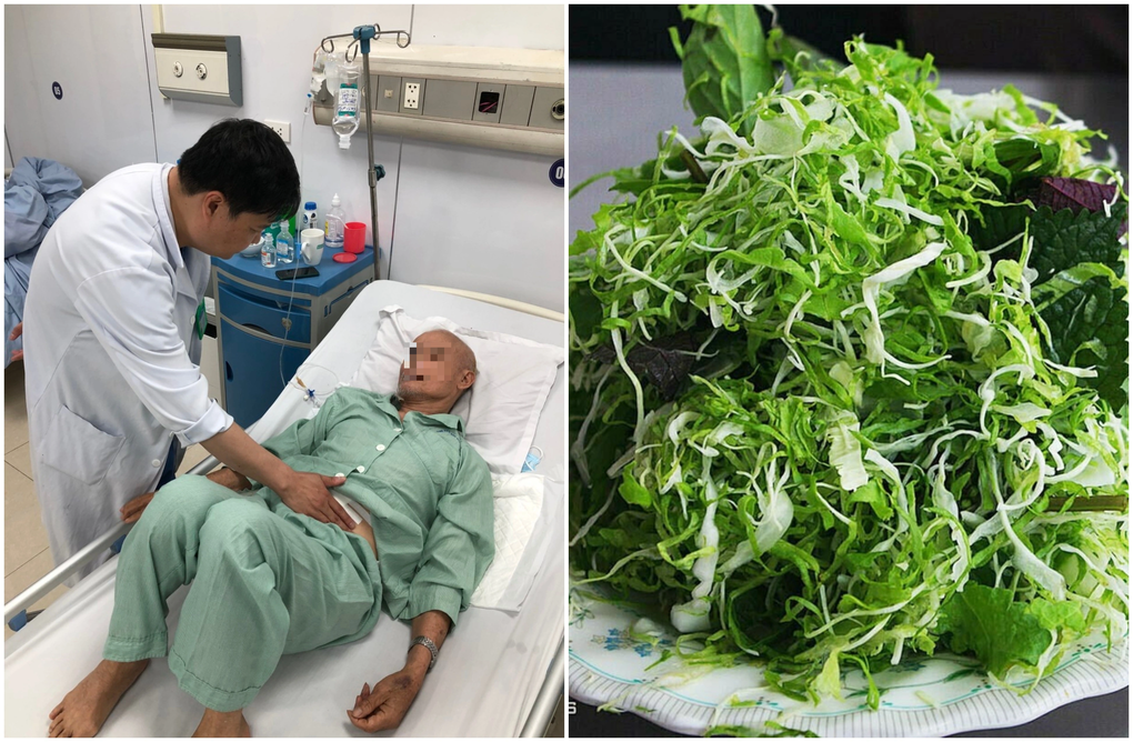 Sau khi ăn thịt lợn và rau sống, người đàn ông hoại tử ruột - 1 Sau khi ăn thịt lợn và rau sống, người đàn ông hoại tử ruột - 1