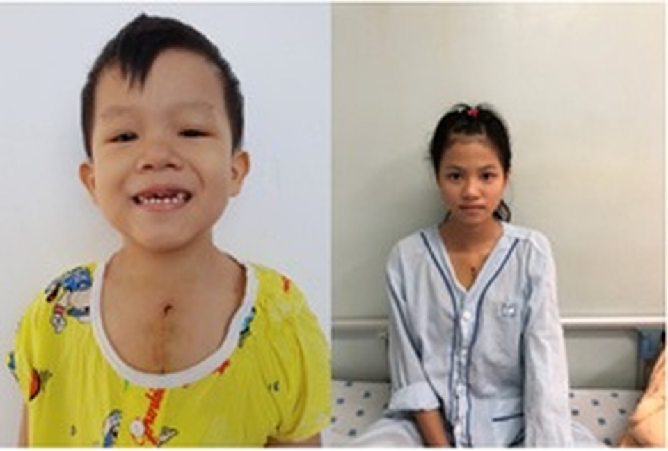 Hành trình chạy vì trái tim cứu sống những trái tim - 1 Hành trình chạy vì trái tim cứu sống những trái tim - 1