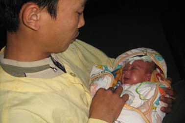 Bé thứ hai trong ca dính nhau xuất viện 