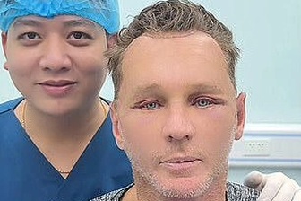 Khách Tây đổi đời sau khi tới Việt Nam phẫu thuật thẩm mỹ