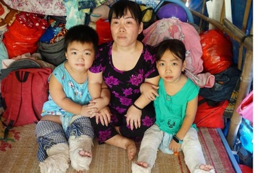 Người phụ nữ có đôi chân "tí hon" và nỗi bất hạnh bị chồng phụ bạc