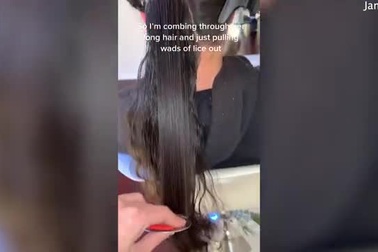 Người thợ làm tóc gây sửng sốt với clip giúp khách hàng xử lý... chấy