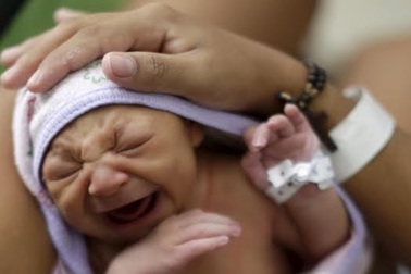 Vi rút Zika gây ra hội chứng đầu nhỏ