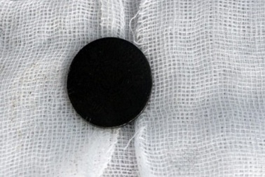 Bé 6 tuổi bị đồng xu chui tọt vào bụng vì chơi trò tung hứng