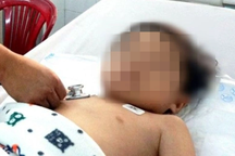 Bà cho dùng paracetamol hàng chục lần trong 2 ngày, cháu 8 tuổi nguy kịch