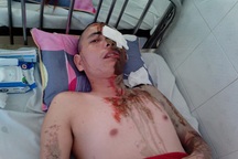 Tạt axit 5 người vì bị ngăn cản tình yêu với cô bé... 10 tuổi