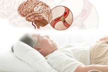 Những điều cần biết về hội chứng ngưng thở khi ngủ