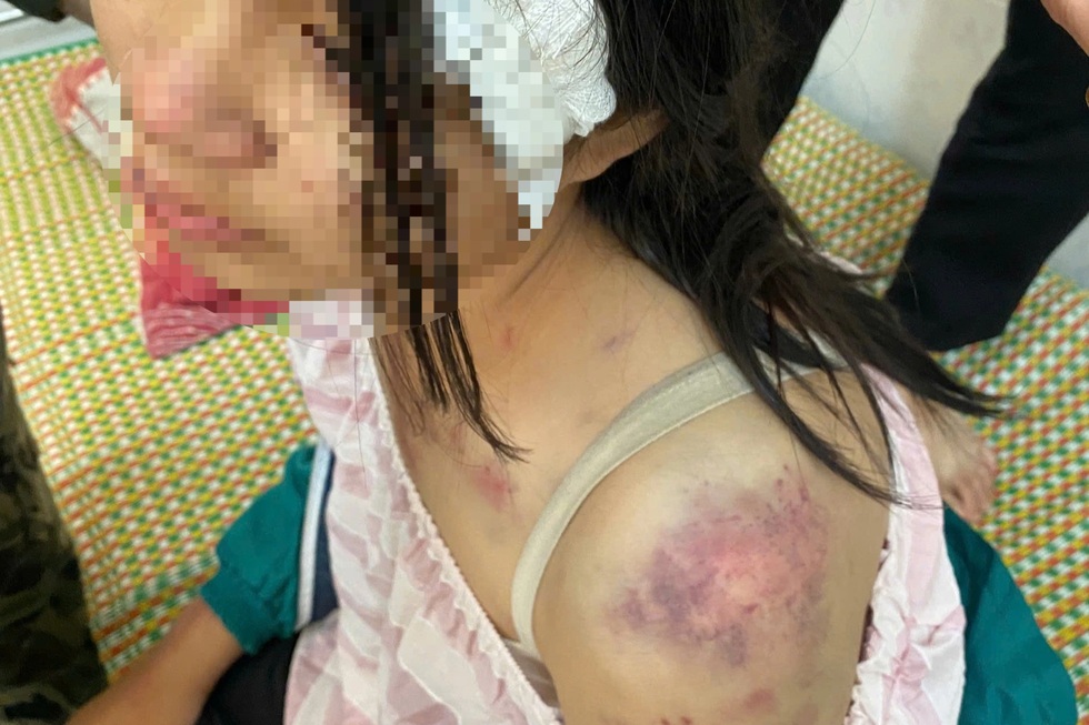 Bốn giờ bạo hành kinh hoàng và cú nhảy tìm đường sống của bé gái 12 tuổi - 1