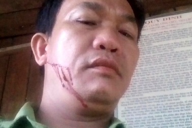 Bắt giam lâm tặc hành hung kiểm lâm trọng thương