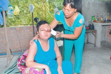 Đau lòng nhìn mắt thiếu nữ sắp nổ tung