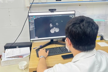 Cậu bé 15 tuổi chân tay co quắp, co giật vì thuốc lá điện tử