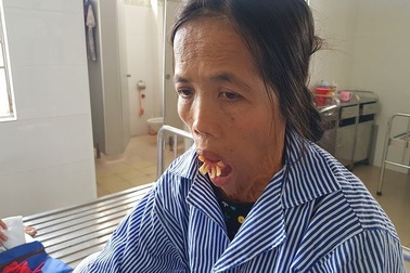 Sau nửa thế kỉ, người đàn bà có hàm răng “kỳ dị” rụt rè khi lần đầu nhập viện