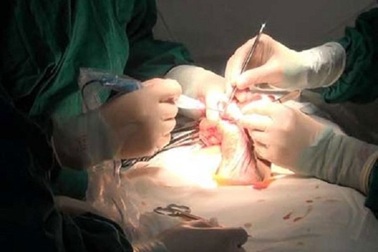 Bác sĩ Việt cứu "cậu nhỏ" tan nát vì bơm silicon cho người đàn ông Lào