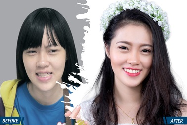 Phẫu thuật thẩm mỹ hàn gắn vết thương tâm hồn cho nhiều người khiếm khuyết