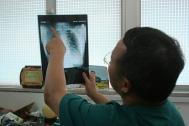 Nuốt kiếm, “nghệ sĩ” đường phố thủng thực quản