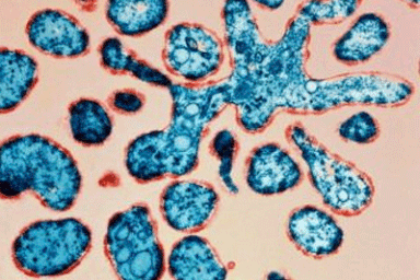 Những điều cần biết về bệnh sởi 