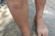 Xử lý vụ 5 cháu nhỏ bị hàng xóm đánh