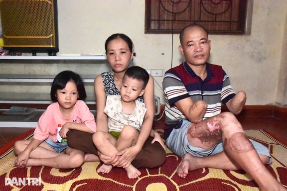 Bố tai nạn cụt 2 tay, mẹ thường đau yếu, 6 con lâm cảnh bế tắc