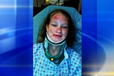 Thiếu nữ bị xe tông vì mải mê chơi Pokemon Go