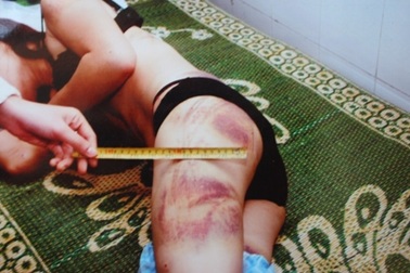 Vụ chồng tra tấn, bắt vợ xem clip sex qua lời khai của 2 “nhân vật”