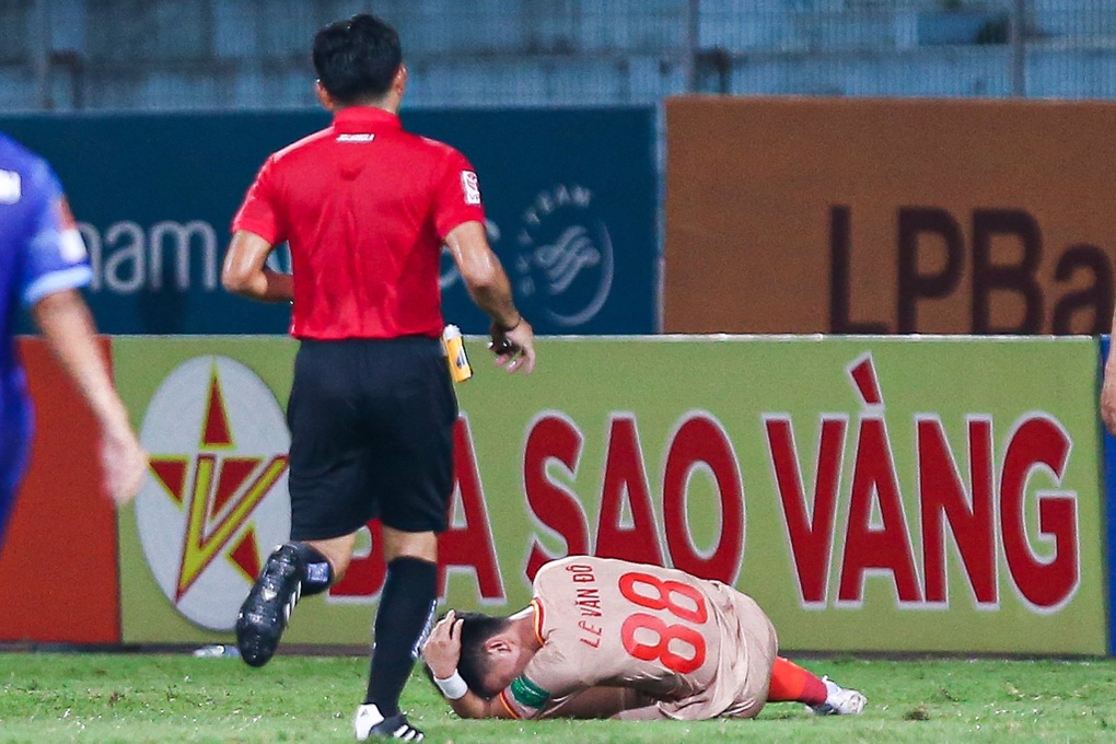 Lê Văn Đô chấn thương nặng trong ngày CLB Công An Hà Nội bị cầm hòa - 4 Lê Văn Đô chấn thương nặng trong ngày CLB Công An Hà Nội bị cầm hòa - 4