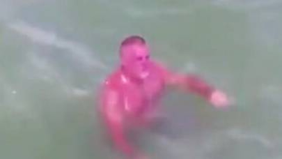 Người đàn ông cháy nắng khủng khiếp bơi giữa đám cá đuối trên biển Florida - 1 Người đàn ông cháy nắng khủng khiếp bơi giữa đám cá đuối trên biển Florida - 1