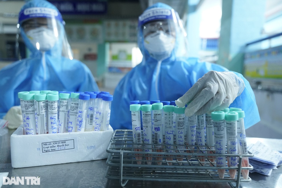 TPHCM: 8 người xét nghiệm lần thứ 5 mới phát hiện nhiễm SARS-CoV-2 - 2 TPHCM: 8 người xét nghiệm lần thứ 5 mới phát hiện nhiễm SARS-CoV-2 - 2